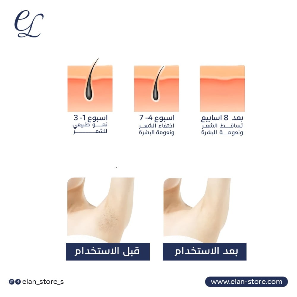 At-Home IPL Hair Removal Handset: Permanent, Painless, & Professional Smooth Skin