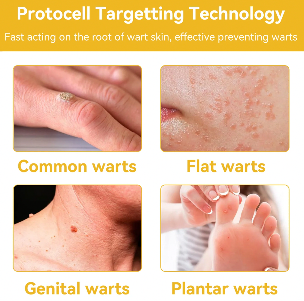 BEE VENOM Skin Restoration Cream – 🌸 Anti-aging, Hydrating, Skin Repair, Even Tone, Acne and Dark Spot Treatment, Wart and Mole Removal, Psoriasis Relief