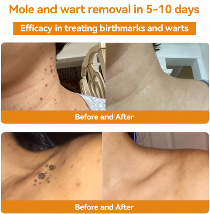 BEE VENOM Skin Restoration Cream – 🌸 Anti-aging, Hydrating, Skin Repair, Even Tone, Acne and Dark Spot Treatment, Wart and Mole Removal, Psoriasis Relief