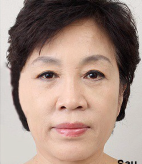 SAAM Young Radiance Serum: Korean Skincare for Brightening and Smooth Skin