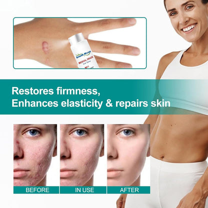 Advanced Scar Remover Spray – Gentle Acne & Dark Spot Solution