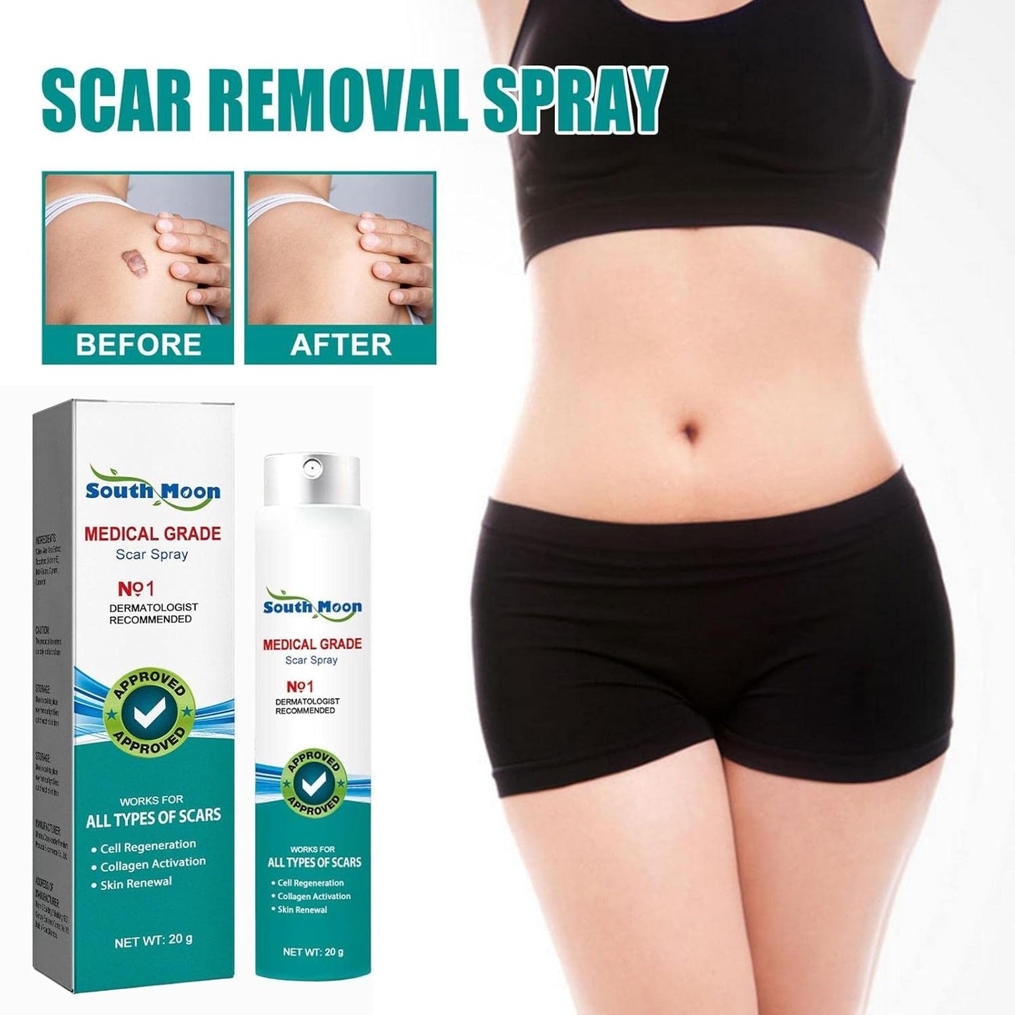 Advanced Scar Remover Spray – Gentle Acne & Dark Spot Solution