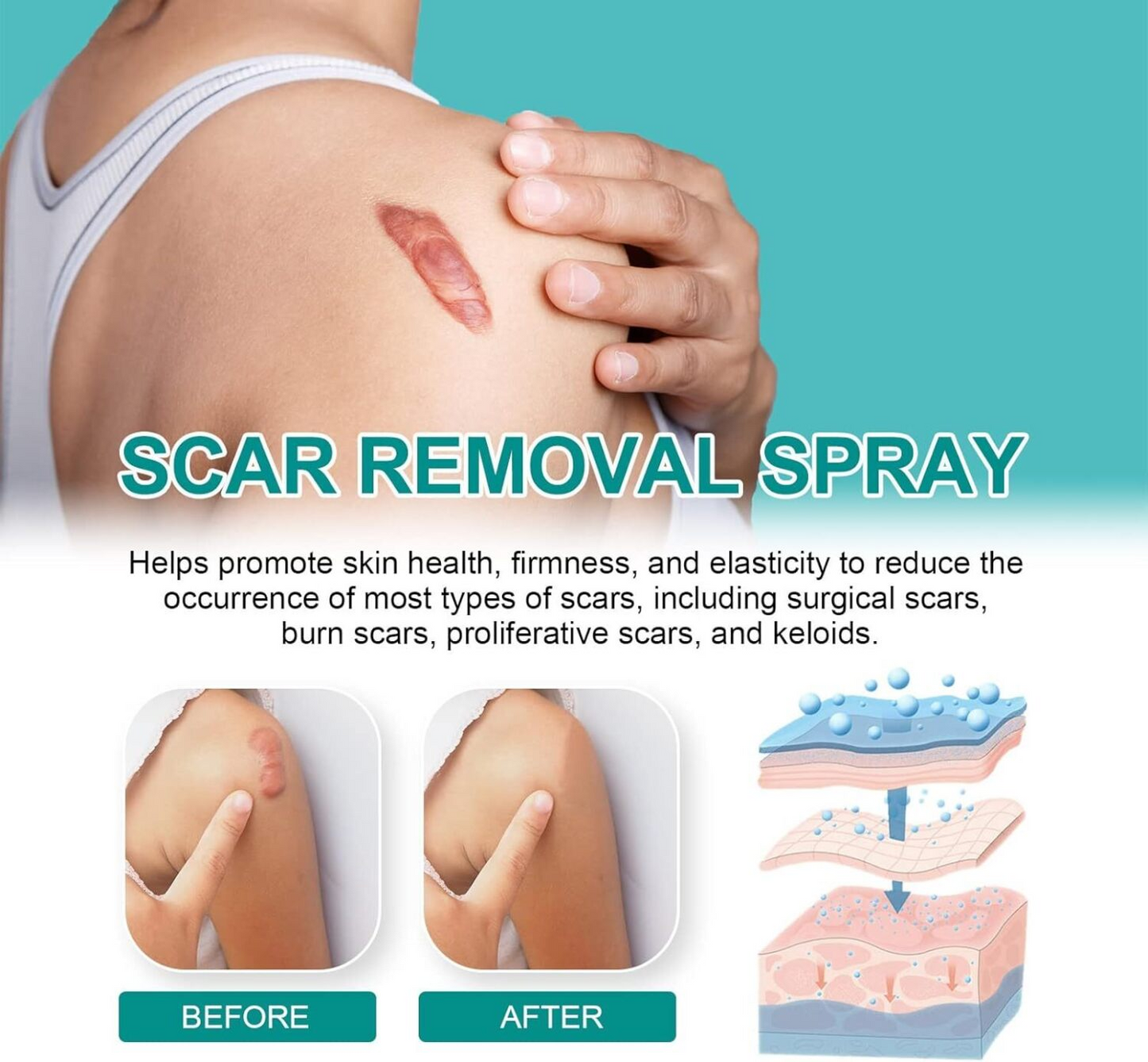 Advanced Scar Remover Spray – Gentle Acne & Dark Spot Solution