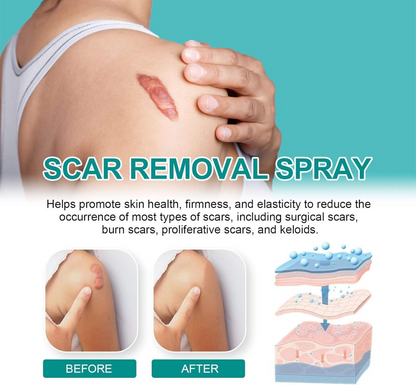Advanced Scar Remover Spray – Gentle Acne & Dark Spot Solution