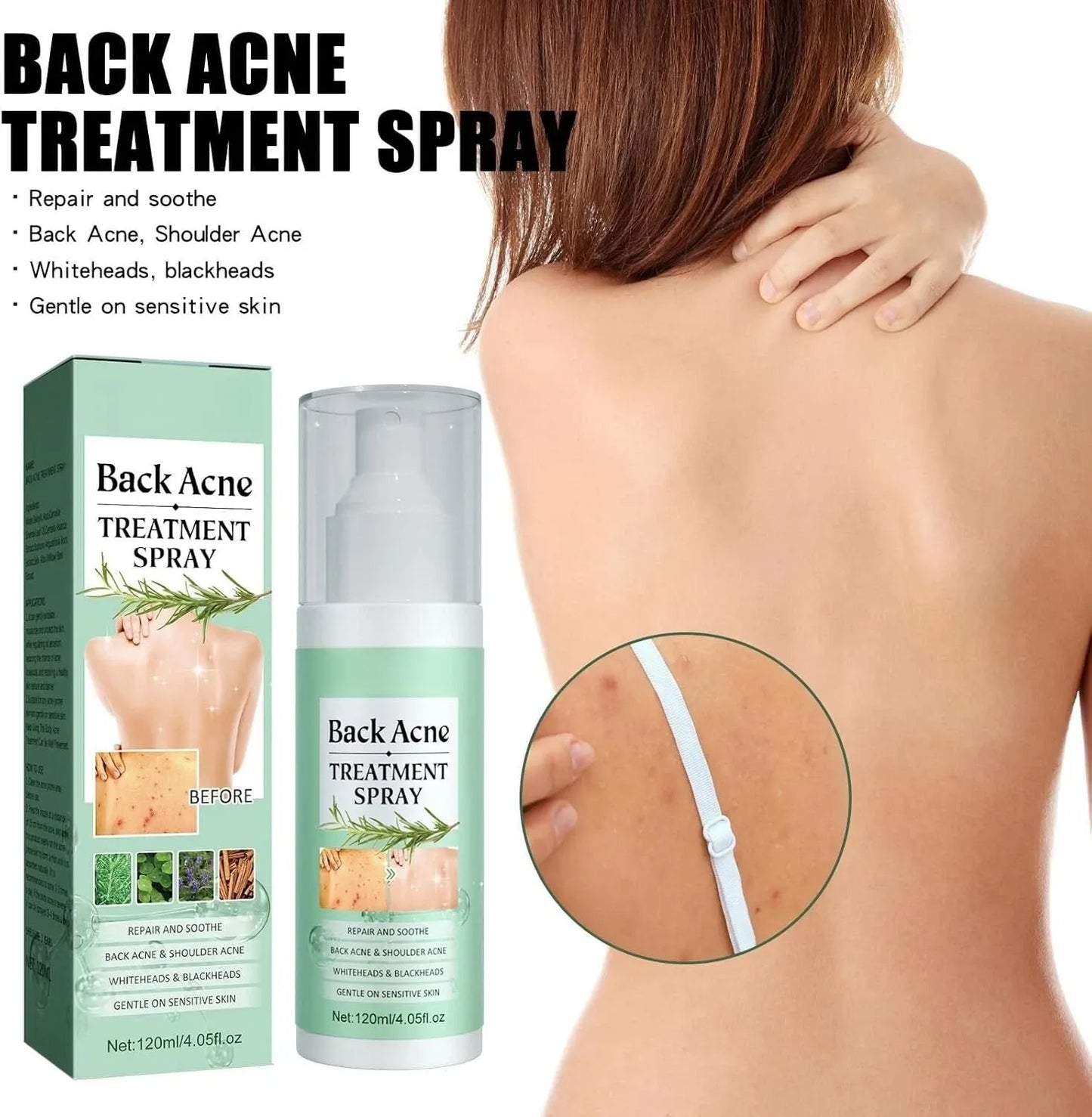 Advanced Scar Remover Spray – Gentle Acne & Dark Spot Solution
